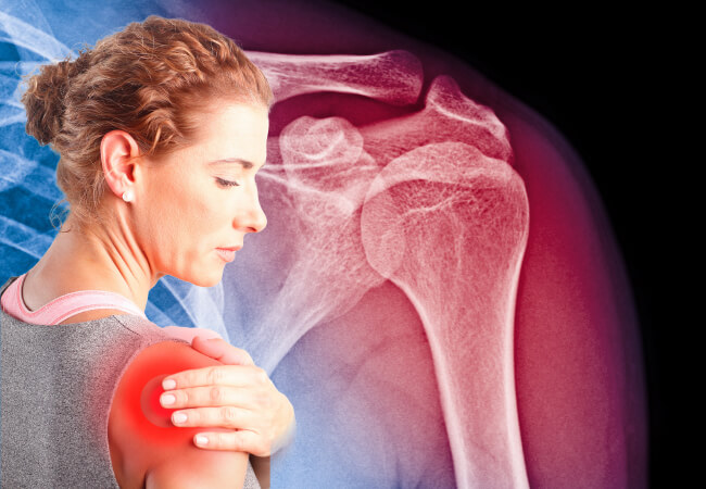 Your Posture Could Be The Culprit Behind Your Shoulder Pain