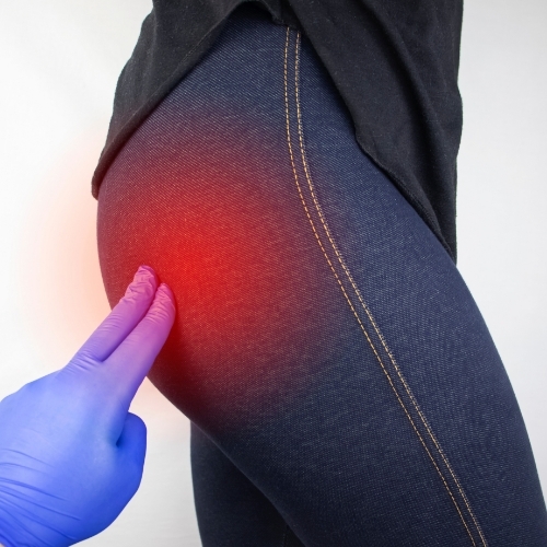 sciatica-pain-relief-Innovative-Physical-Therapy-Solutions-Watertown-NY