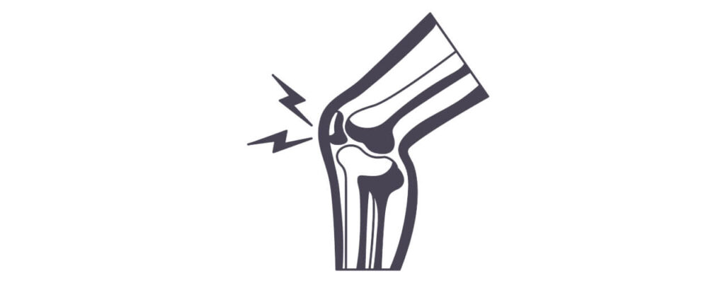 Physical Therapy Strategies for Knee Pain Relief